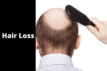 How to Reduce Hair Loss Male?